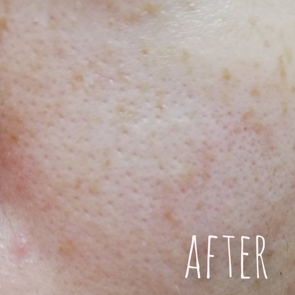 ソワン/BIRAI IN/美容液を使ったクチコミ(4枚目)