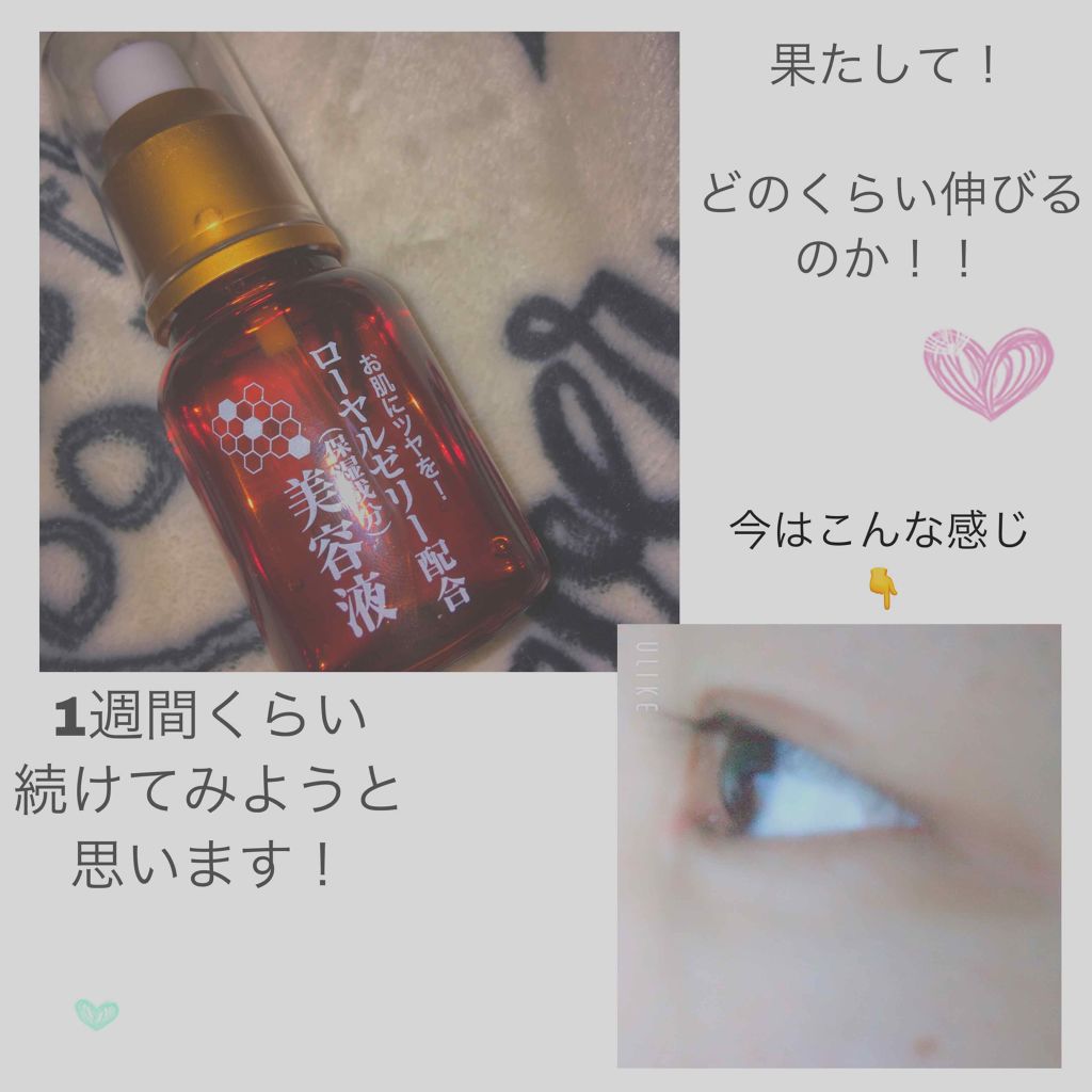 ローヤルゼリー配合 栄養ローション/DAISO/美容液を使ったクチコミ（1枚目）