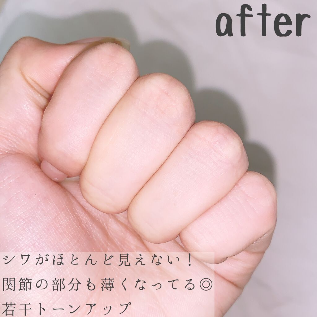 白ゆび姫 Himecotoの口コミ 綺麗は指先から𓂃𓈒𓂂𓏲 めざせ指先美人 By Iris 敏感肌 Lips