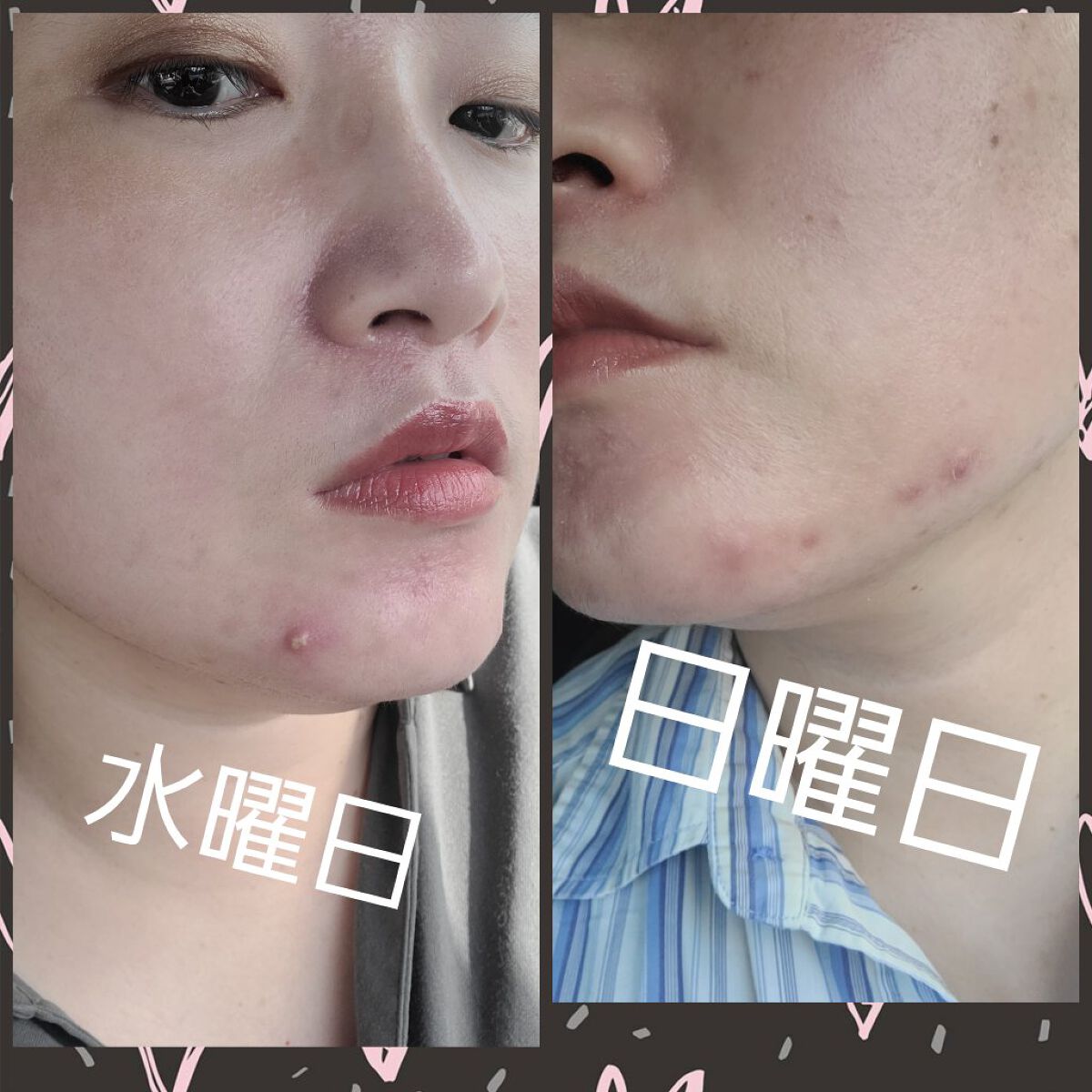 グリーン ダーマCICAビックトナー/ネイチャーリパブリック/化粧水を使ったクチコミ（3枚目）