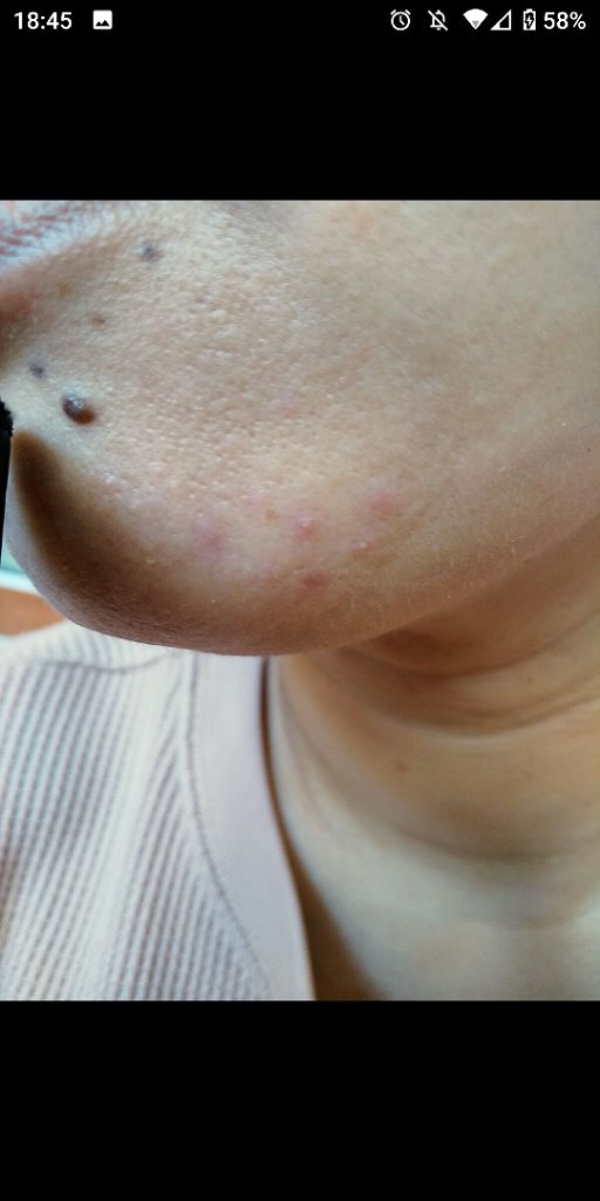 薬用しみ集中対策 プレミアム美容液/メラノCC/美容液を使ったクチコミ（2枚目）