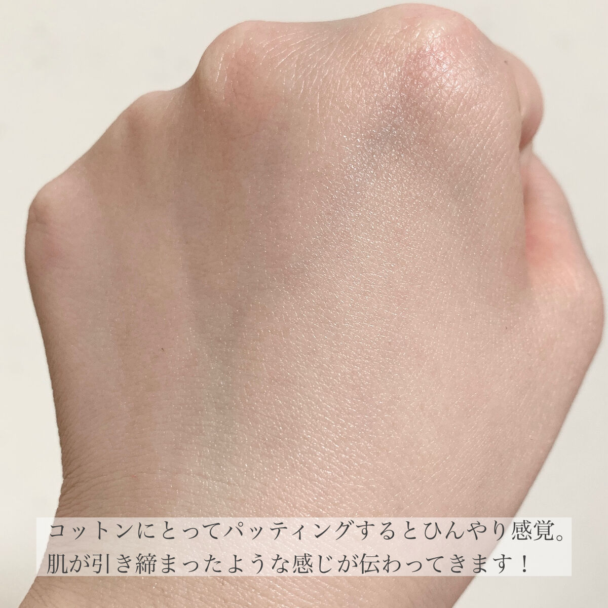  薬用スキンコンディショナーエッセンシャル N/ALBION/化粧水 by ﾔﾏｼﾀ