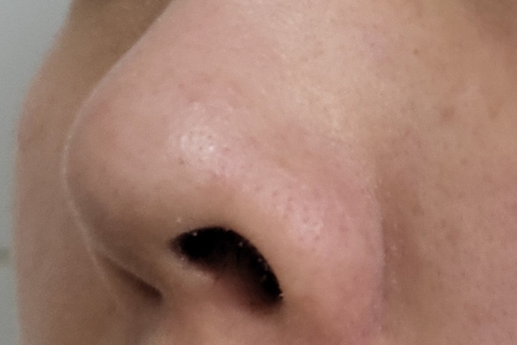 プバラセボムサクション/DIDIDA/美顔器・マッサージを使ったクチコミ（1枚目）