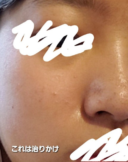 白潤 薬用美白化粧水/肌ラボ/化粧水を使ったクチコミ(2枚目)