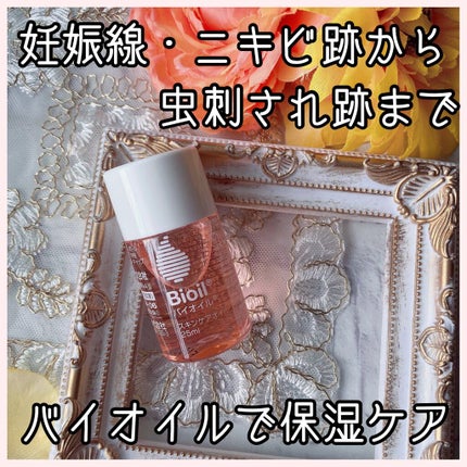 バイオイル/バイオイル/フェイスオイルを使ったクチコミ(1枚目)
