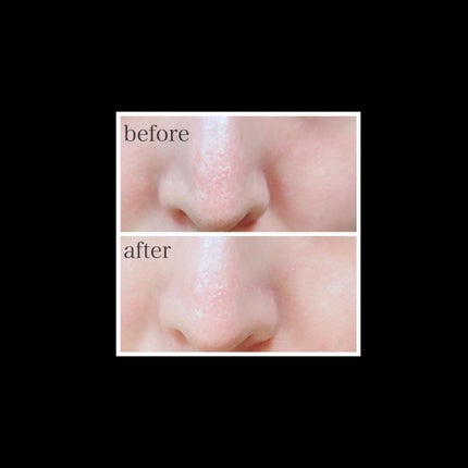 ナチュラルマイルドクリアノーズパック/ilso/シートマスク・パックを使ったクチコミ(3枚目)