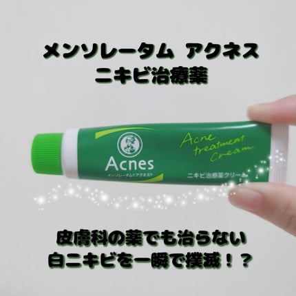 ニキビ治療薬(医薬品)/メンソレータム アクネス/その他を使ったクチコミ(1枚目)