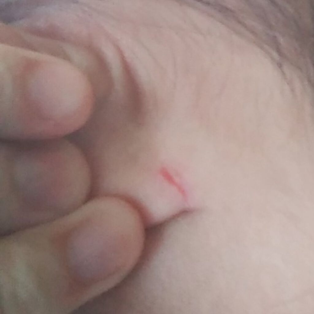 白色ワセリン(医薬品)/健栄製薬/その他を使ったクチコミ（3枚目）