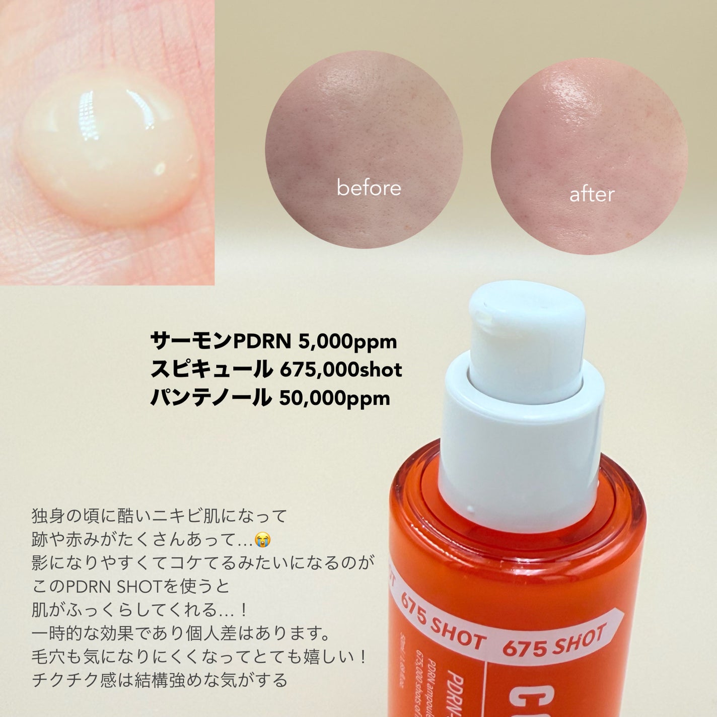PDRNショット675/COSNORI/美容液を使ったクチコミ(2枚目)