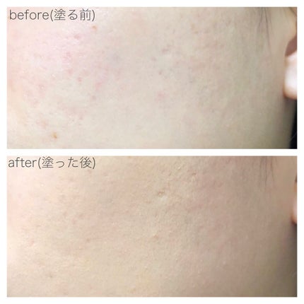 M クッションファンデーション(ネオカバー)/MISSHA/クッションファンデーションを使ったクチコミ(5枚目)