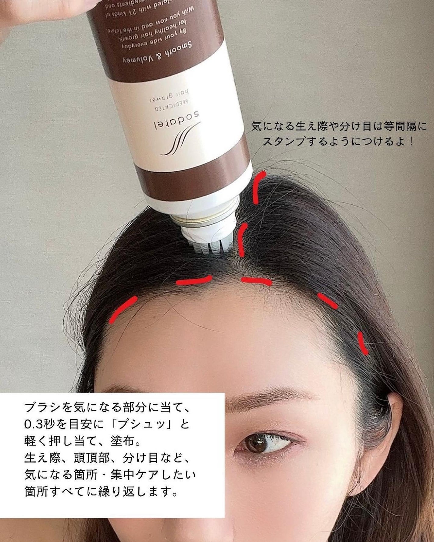 薬用炭酸ヘッドスパ育毛剤/sodatel/頭皮ローションを使ったクチコミ(4枚目)