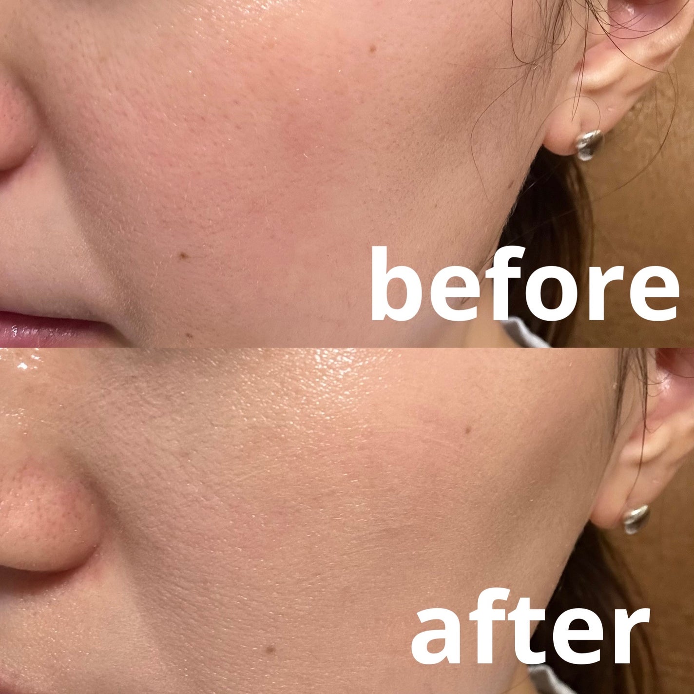 薬用 リンクルホワイトBBクリーム/ONLY MINERALS/BBクリームを使ったクチコミ(3枚目)