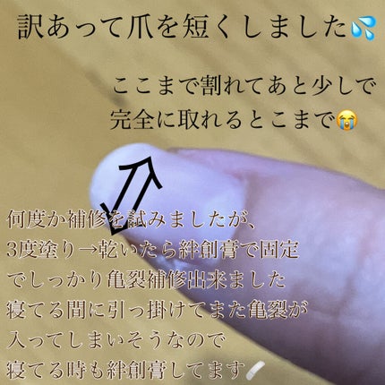 スプリットリペアN/ネイルネイル/ネイルオイル・トリートメントを使ったクチコミ(4枚目)