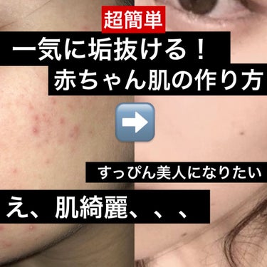 すあ (フォロバ) on LIPS 「赤ちゃん肌に貴方もなれる！簡単美容法15選🌟肌綺麗！ずっと触っ..」（1枚目）