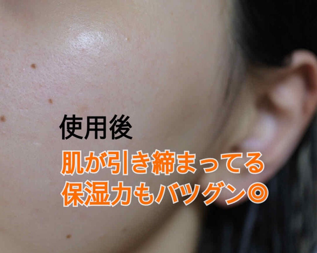 スーパー毛穴エッセンスローション/ラボラボ/化粧水を使ったクチコミ(3枚目)