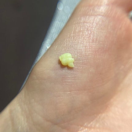 Vita-A Cream/Dr.Different/フェイスクリームを使ったクチコミ(3枚目)