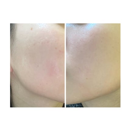 を使ったクチコミ(1枚目)