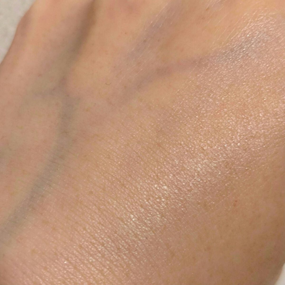 ハトムギ化粧水(ナチュリエ スキンコンディショナー R )/ナチュリエ/化粧水を使ったクチコミ(8枚目)