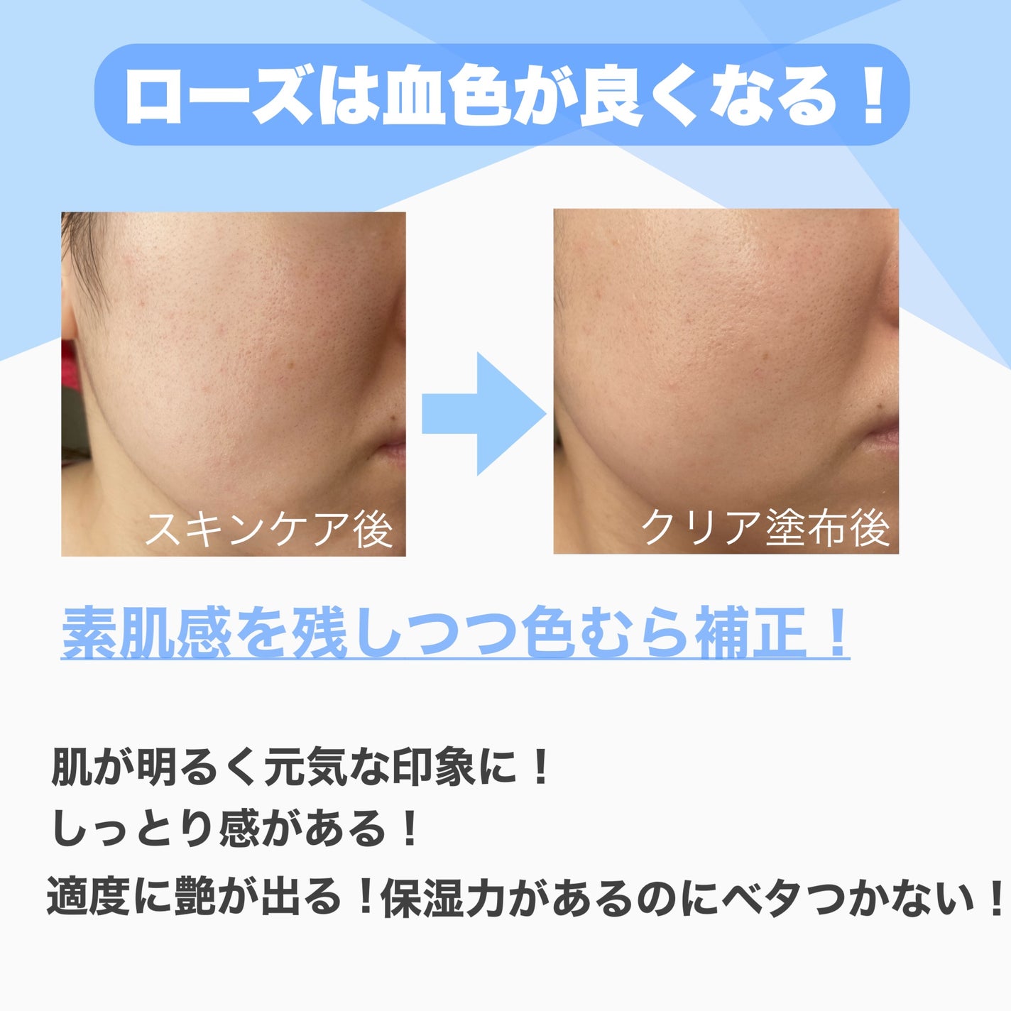 UVã€ã㢠XL ãããã¯ã·ã§ã³ããŒã³ã¢ãã ããŒãº/ã© ããã·ã¥ ããŒ/æ¥çŒãæ¢ãã¯ãªãŒã ã䜿ã£ãã¯ãã³ãïŒ7æç®ïŒ