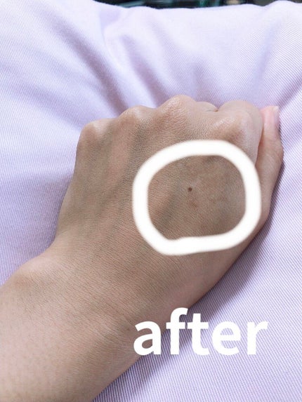 スムースEクリーム/SMOOTH E/フェイスクリームを使ったクチコミ(2枚目)