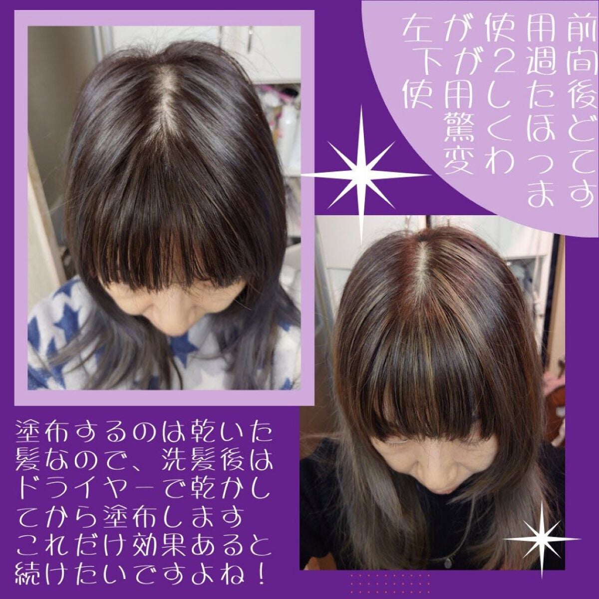 Wアプローチヘアプログラム/MUNOAGE(ミューノアージュ)/頭皮ローションを使ったクチコミ(5枚目)