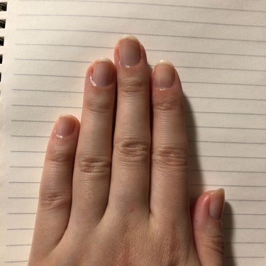 個人的育爪日記　7
停滞期。でも親指だけはハイポニキウムも含めしっかり伸びてる。
ぼーっとしてやすりをかけてたらかなり短くしてしまったのも悪かったかも。
そしてなんだかんだ忙しくて保湿する頻度も下がって