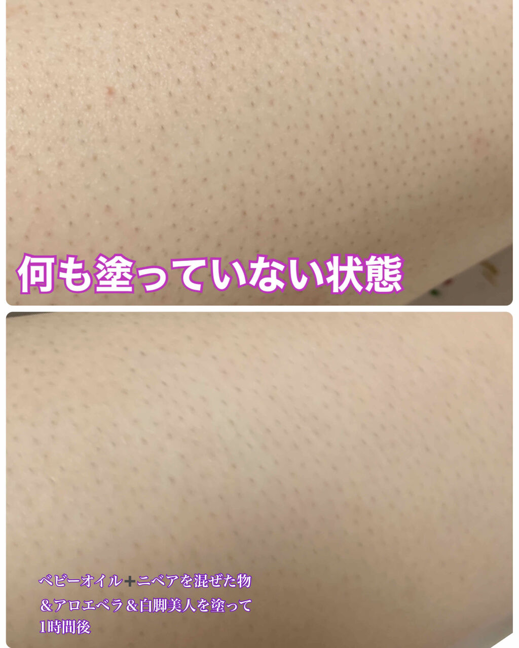 ニベアクリーム/ニベア/ボディクリームを使ったクチコミ（3枚目）