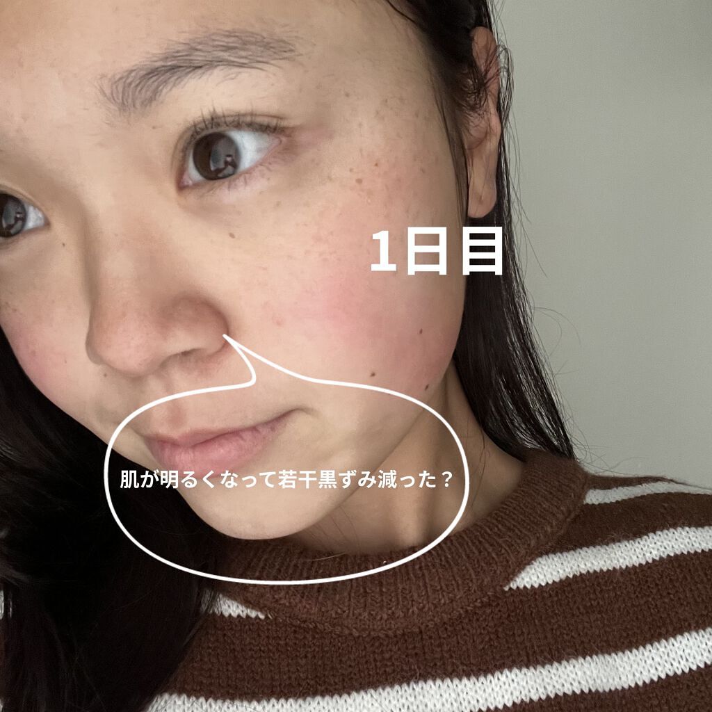 アップル AHA クリアリング パッド/goodal/トナーパッドを使ったクチコミ（3枚目）