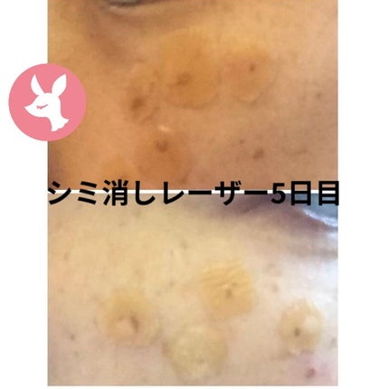 を使ったクチコミ(3枚目)