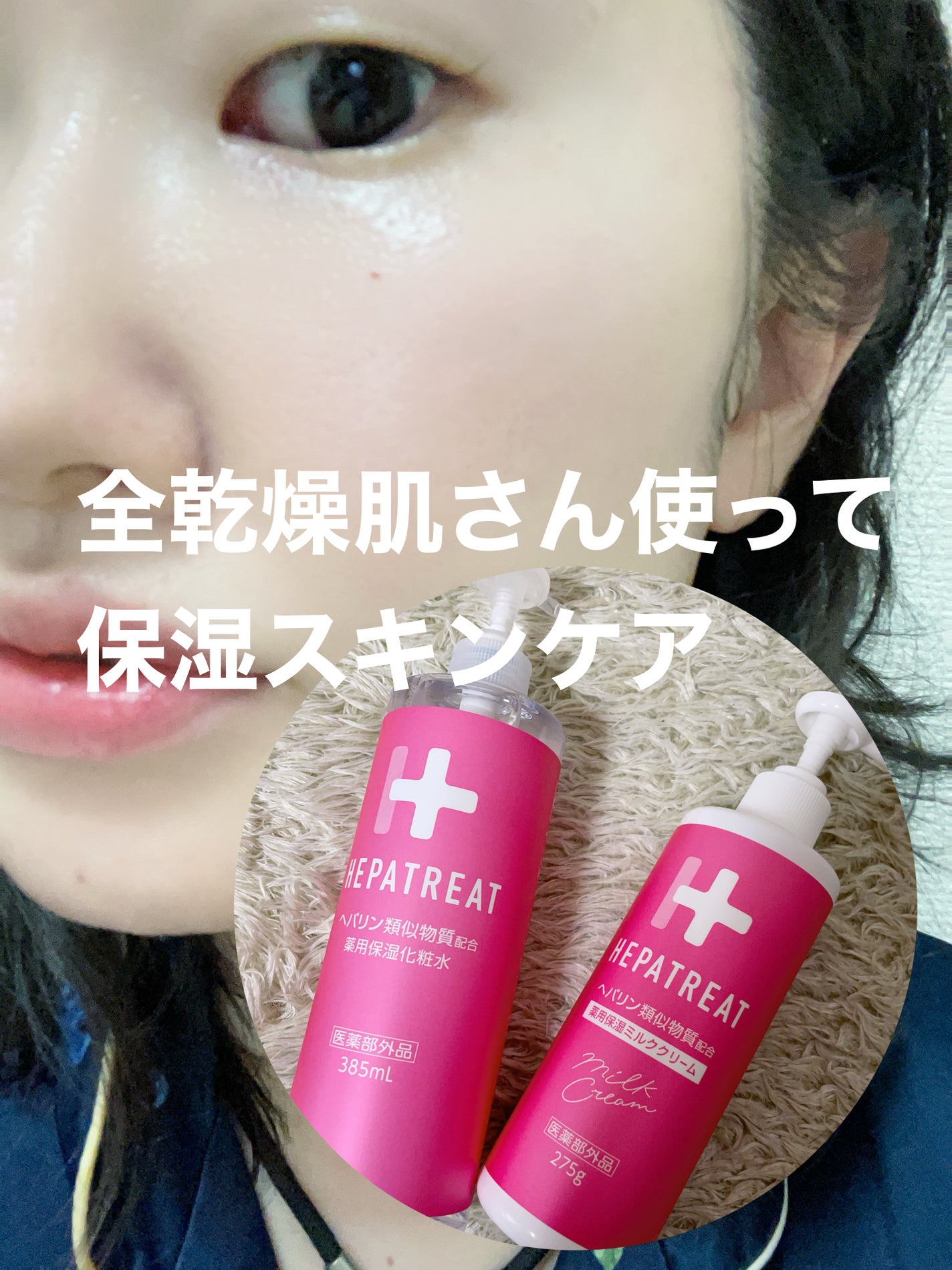 ヘパトリート 薬用保湿化粧水/ゼトックスタイル/化粧水を使ったクチコミ(1枚目)