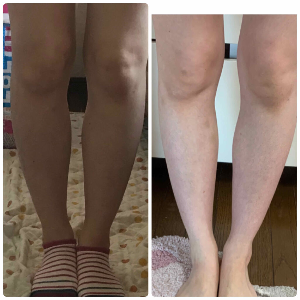 寝ながらメディキュット ロング/メディキュット/着圧ソックス・レギンスを使ったクチコミ（2枚目）