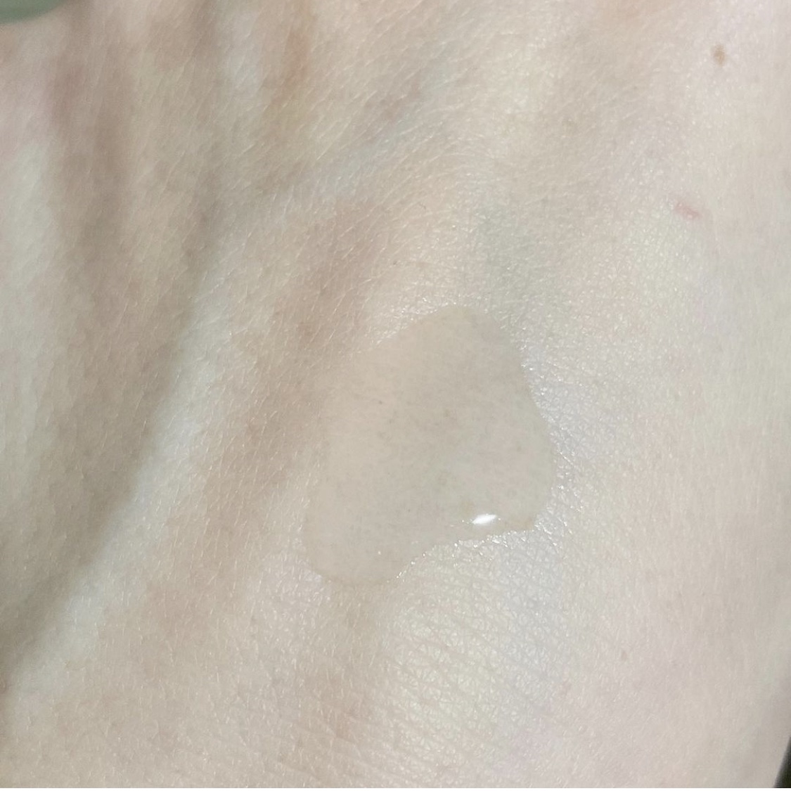 スーパーリンクルローション VA/KISO/化粧水を使ったクチコミ（2枚目）