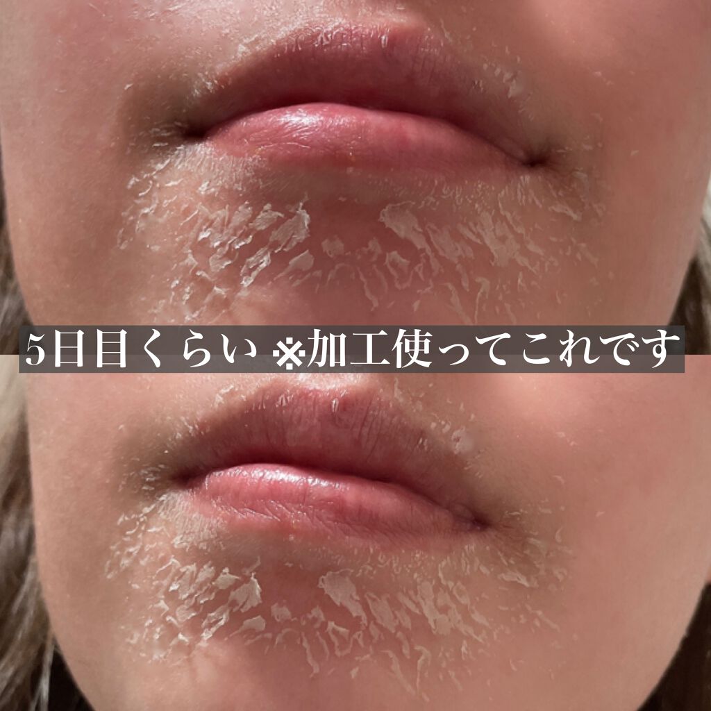 ミラミックス/ZO Skin Health/フェイスクリームを使ったクチコミ（3枚目）