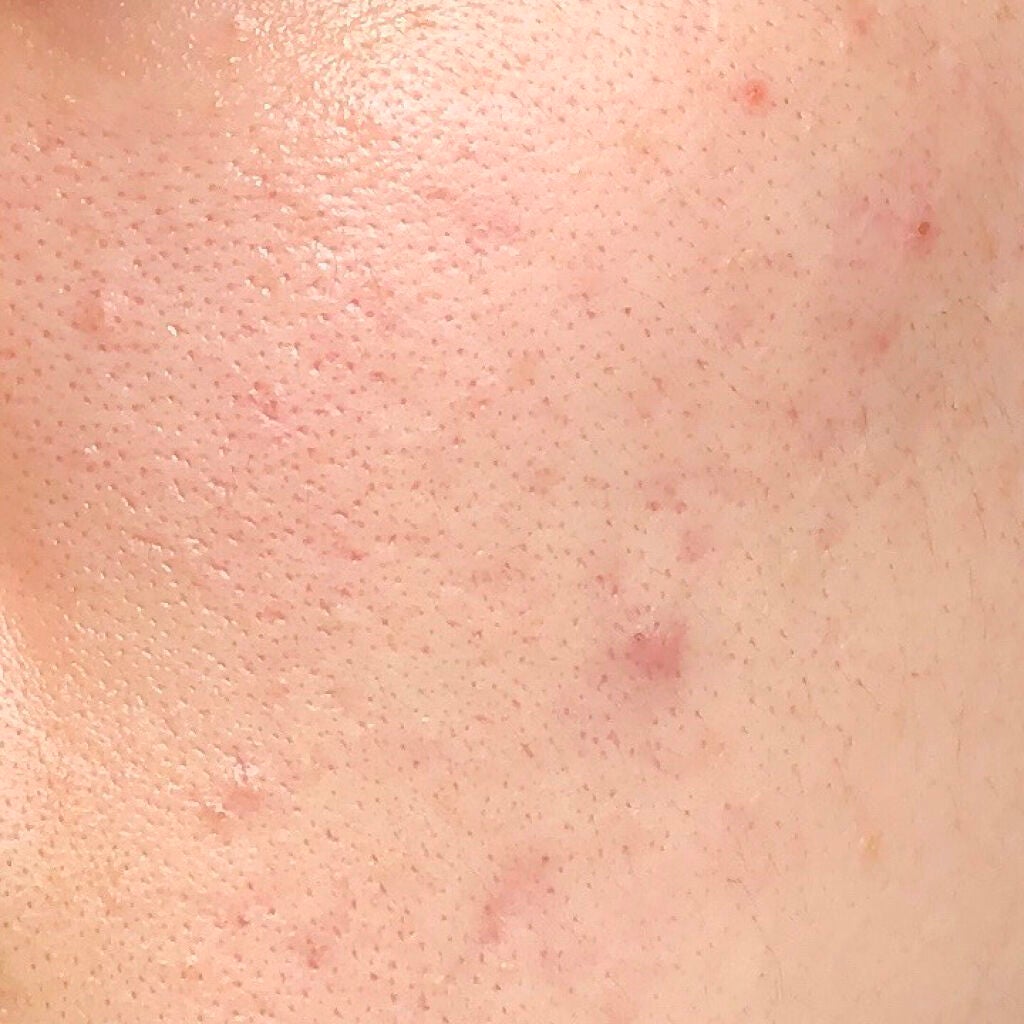 ネオクッション マット/LANEIGE/クッションファンデーションを使ったクチコミ(4枚目)