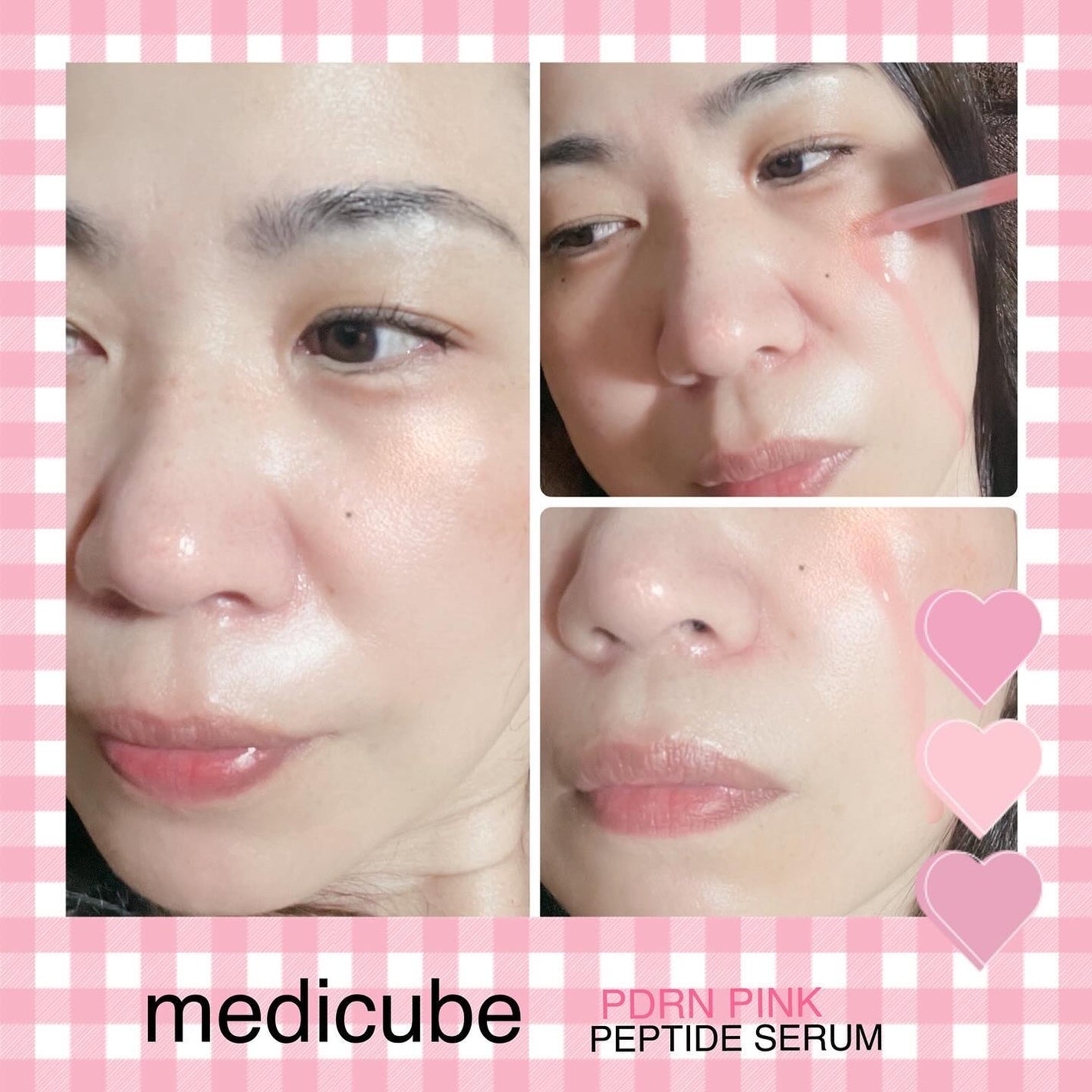 PDRNピンクアンプル PDRN 10,000ppm配合/MEDICUBE/美容液を使ったクチコミ(3枚目)