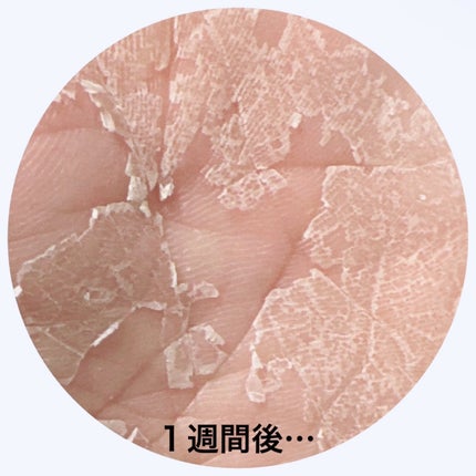 足裏角質ケアパック/3COINS/レッグ・フットケアを使ったクチコミ(5枚目)