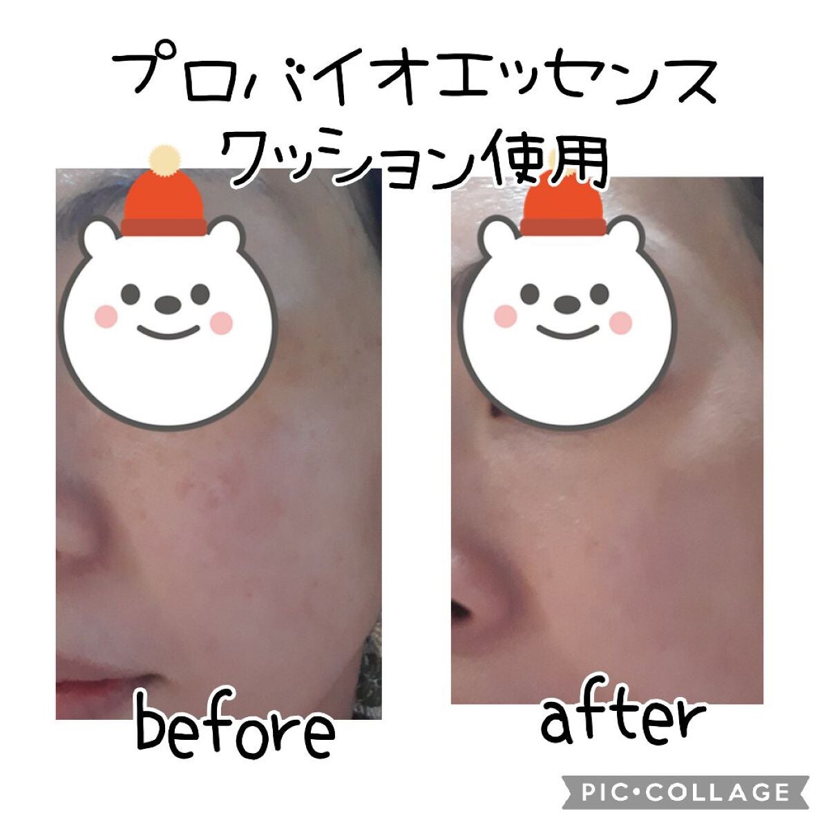 PROBIOエッセンスクッション/ネイチャーリパブリック/クッションファンデーションを使ったクチコミ(4枚目)