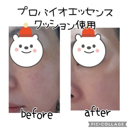 PROBIOエッセンスクッション/ネイチャーリパブリック/クッションファンデーションを使ったクチコミ(4枚目)