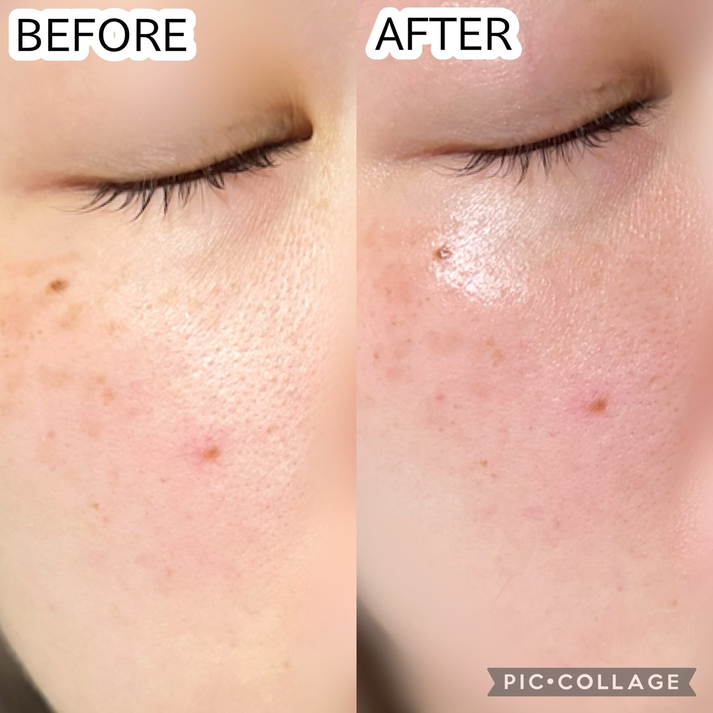 レッドブレミッシュスージングアップサン/Dr.G/日焼け止めクリームを使ったクチコミ(4枚目)