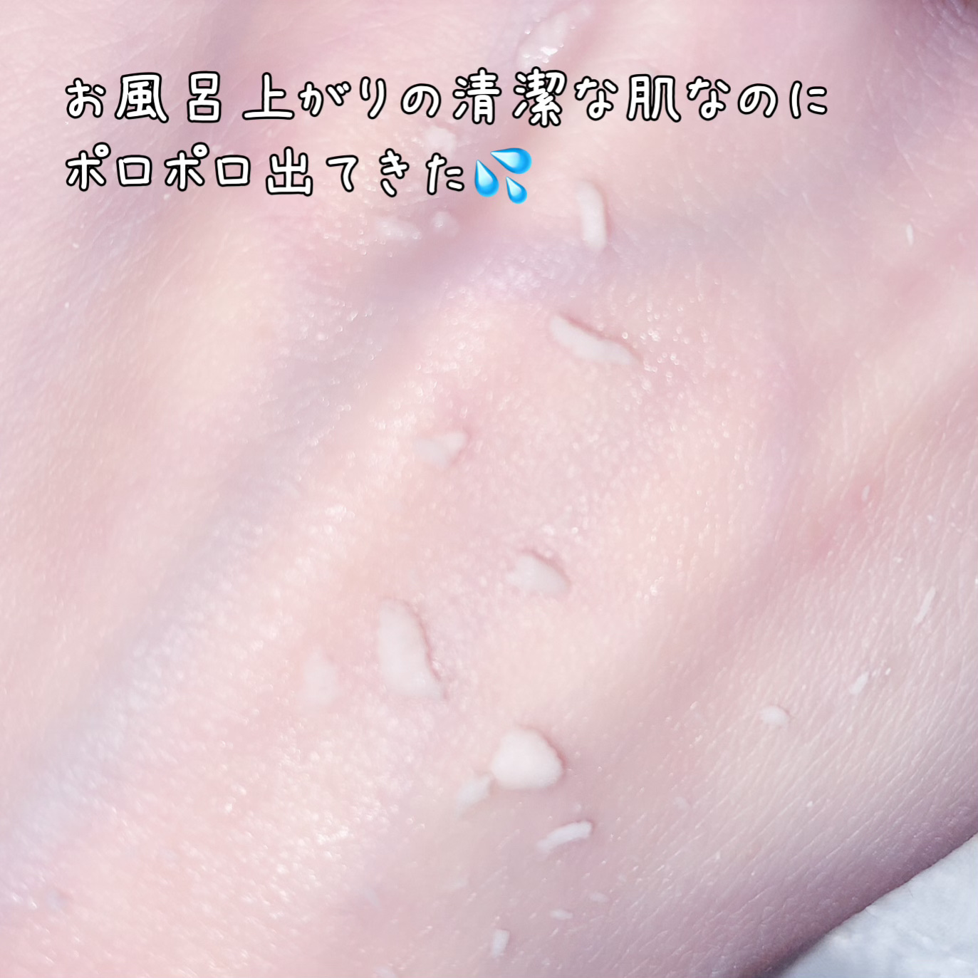 ブライトニングピーリングジェル/Dr.G/ピーリングを使ったクチコミ（3枚目）