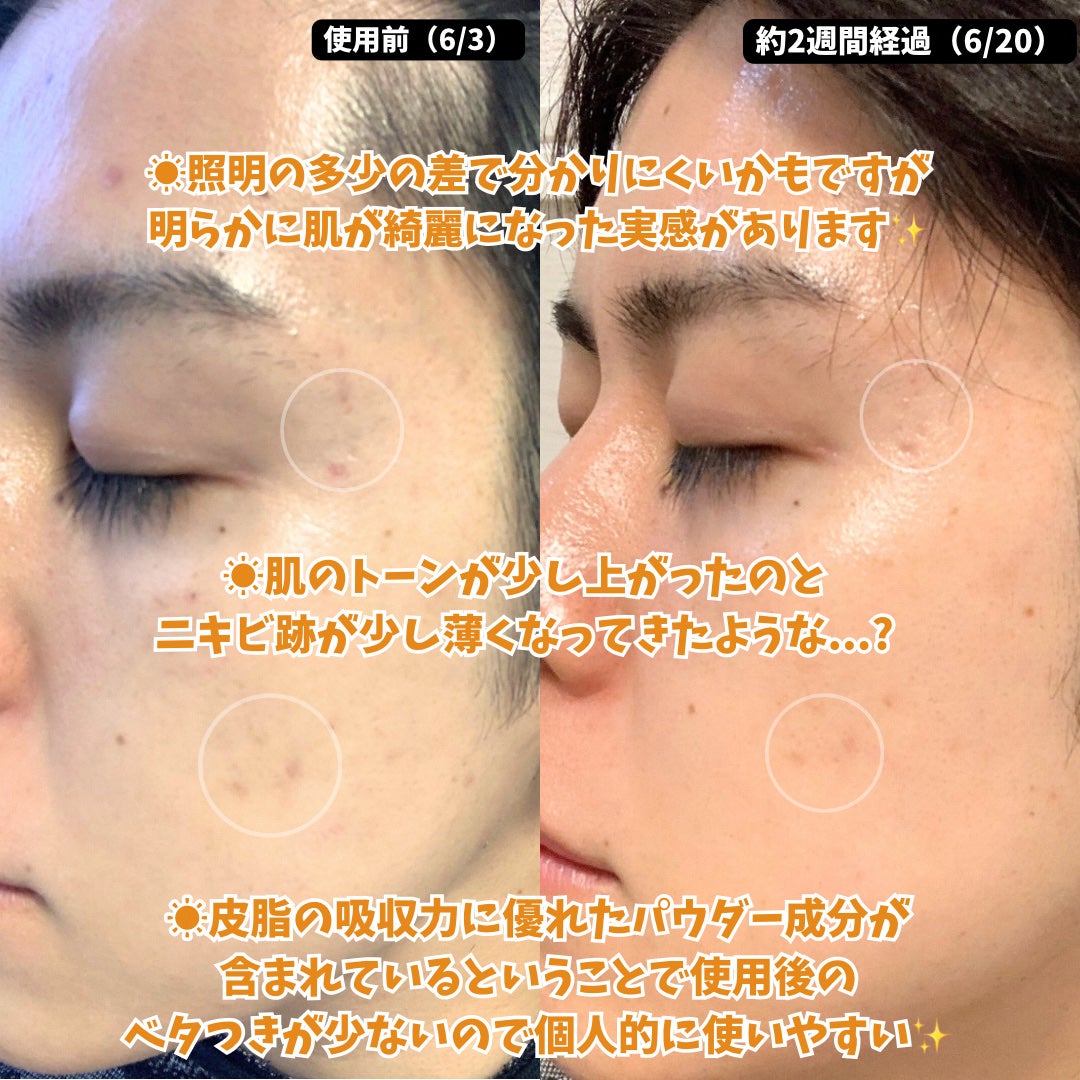 TXトーニングエッセンス1000SHOT/VT/美容液を使ったクチコミ(5枚目)