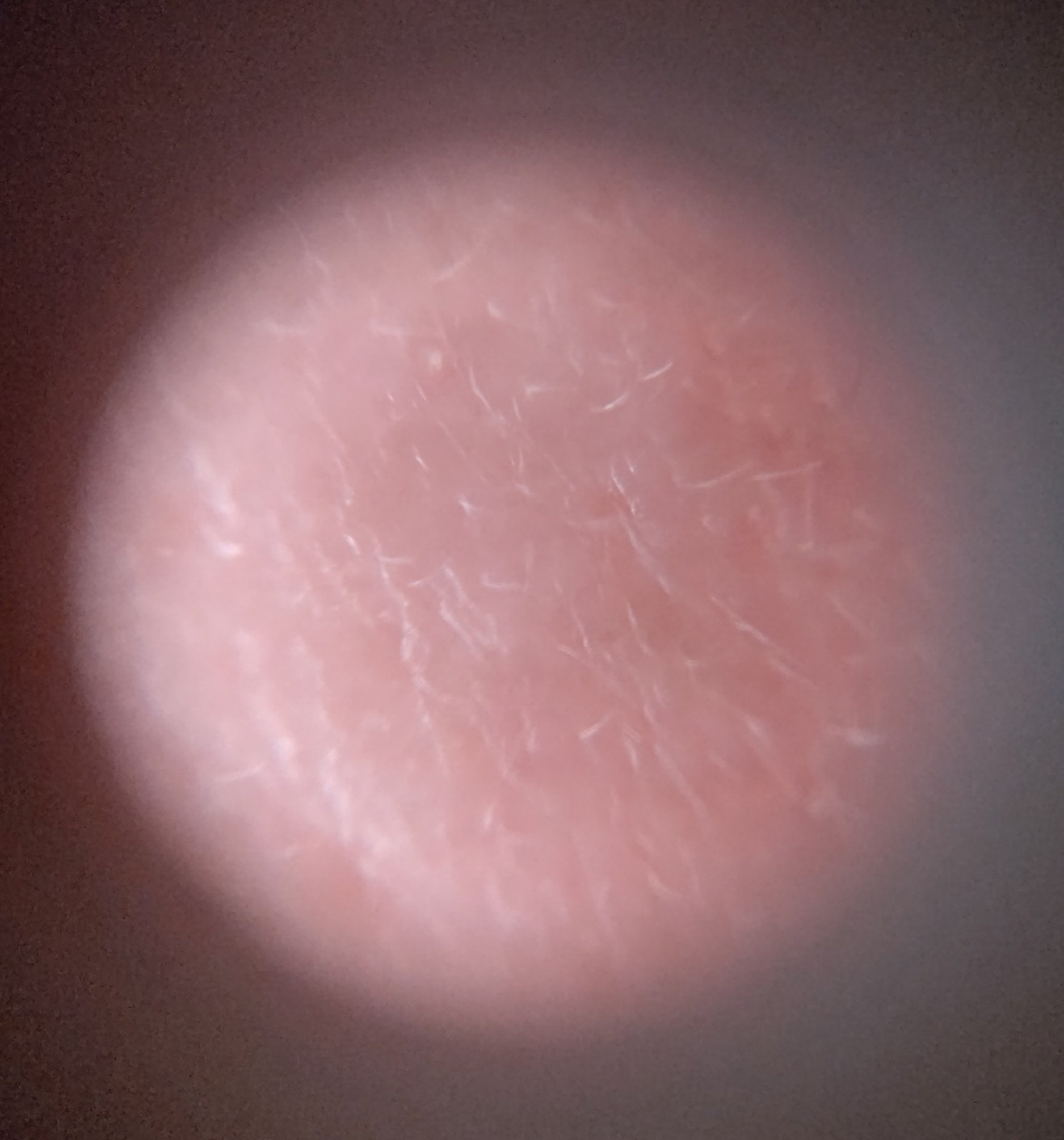 シカコラーゲンオールインワン３ステップマスク/VT/シートマスク・パックを使ったクチコミ（2枚目）