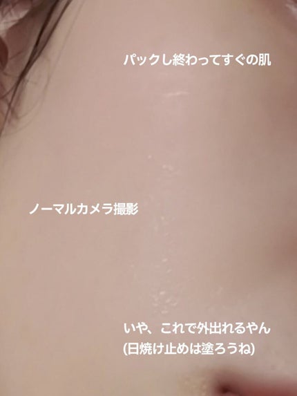 クリアエッセンスマスク/ピュレア/シートマスク・パックを使ったクチコミ(6枚目)