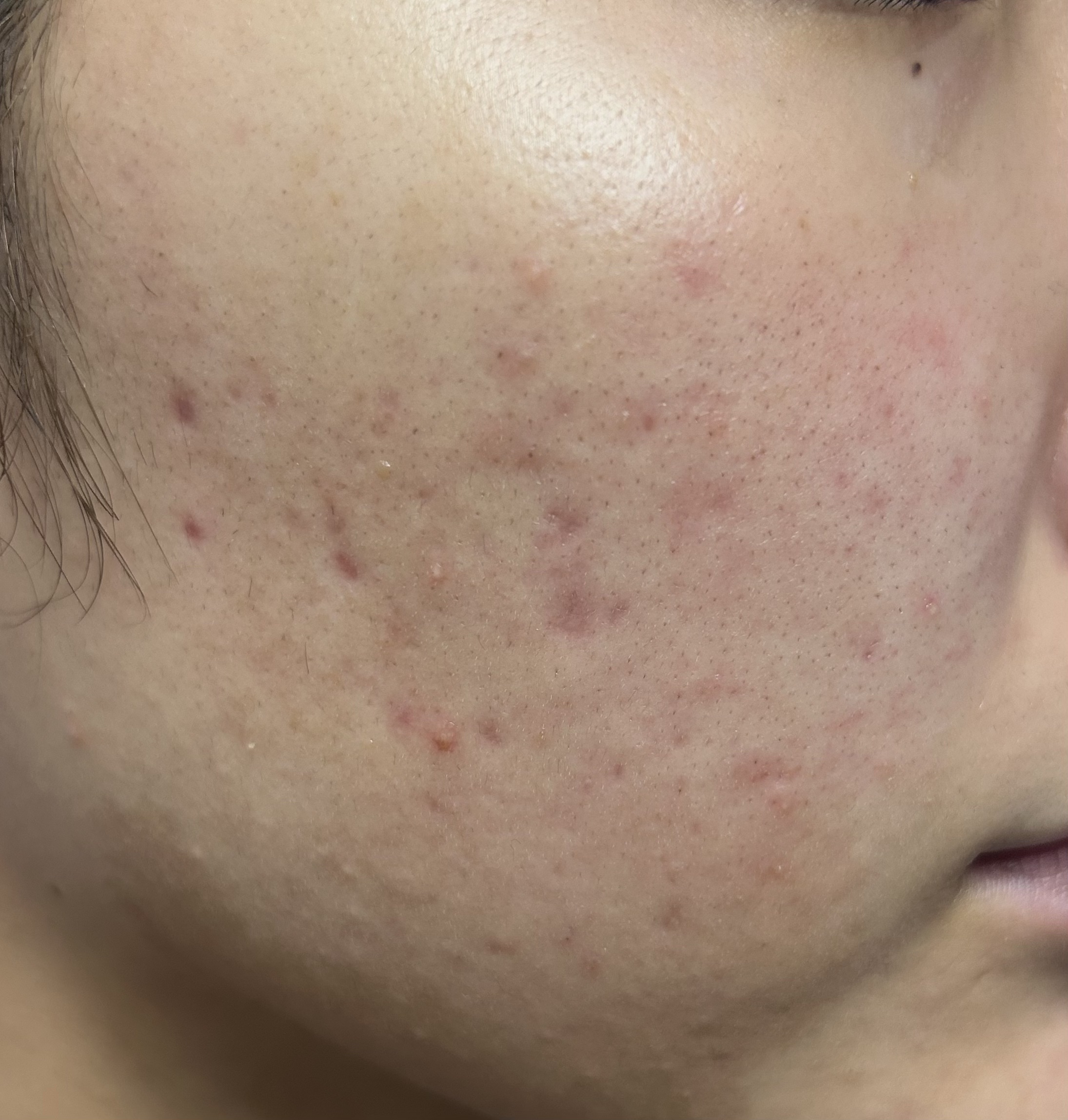 グリーンダーマCICA デイリーシートマスク/ネイチャーリパブリック/シートマスク・パックを使ったクチコミ（2枚目）