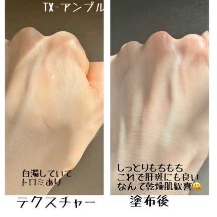 TX-Cream/Dr.Melaxin/フェイスクリームを使ったクチコミ(3枚目)