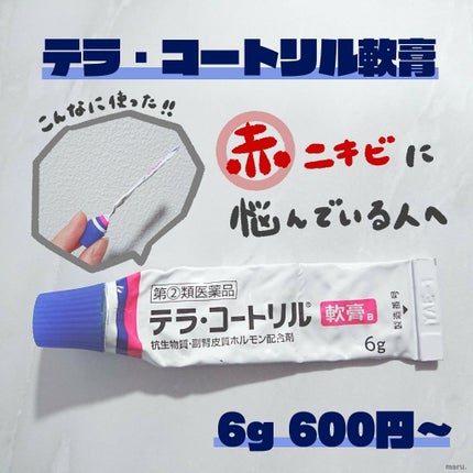 テラ・コートリル 軟膏(医薬品)/ジョンソン・エンド・ジョンソン/その他を使ったクチコミ(1枚目)