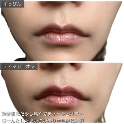 ウォーターフルリッププランパー/COSNORI/リッププランパーを使ったクチコミ(6枚目)