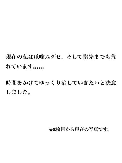 ネイルサポート Na/ネイルネイル/ネイルトップコートを使ったクチコミ(1枚目)