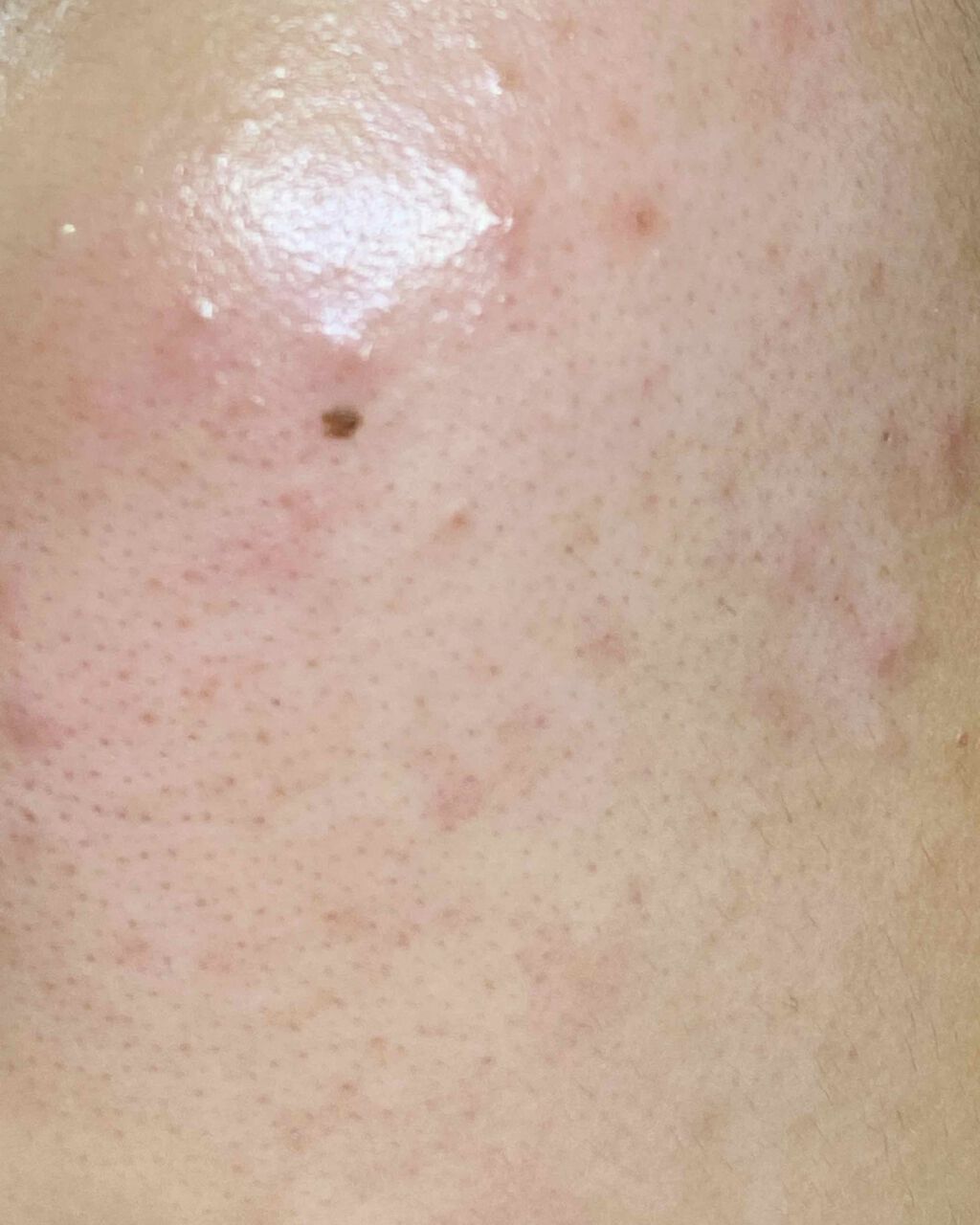 ロゼット洗顔パスタ アクネクリア/ロゼット/洗顔フォームを使ったクチコミ(2枚目)