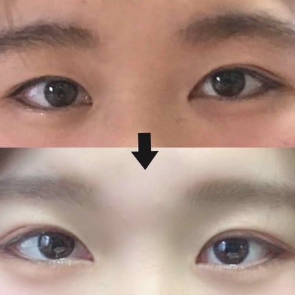 アクティブアイトークII/アイトーク/二重まぶた用アイテムを使ったクチコミ(1枚目)